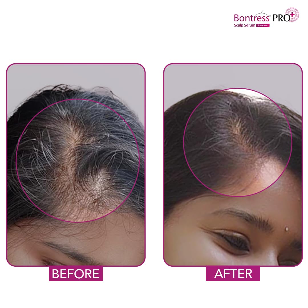 Bontress PRO+ Hair Growth Serum
