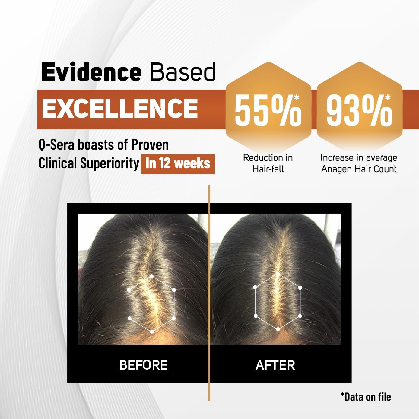 QSERA Hair Growth seram