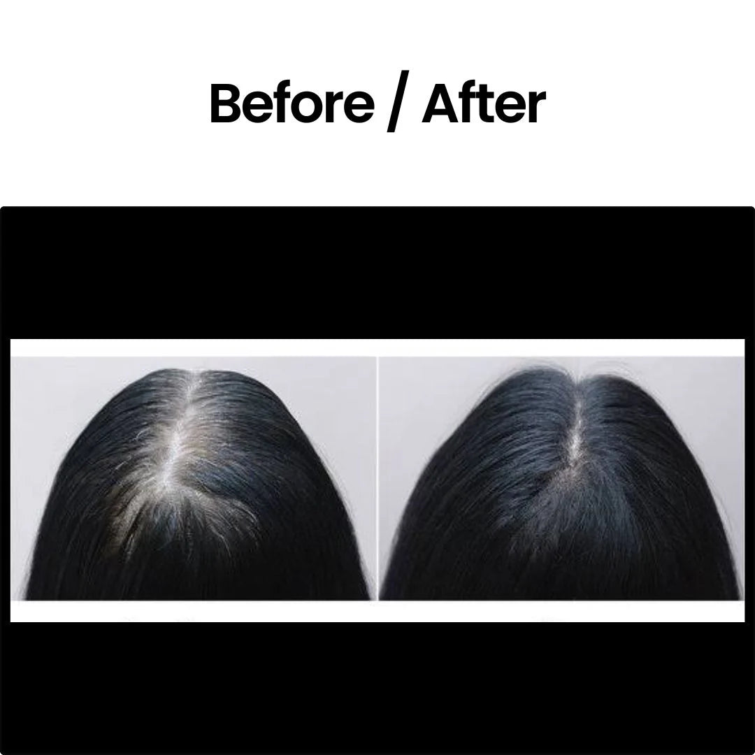Proskire Intense Hair Growth Serum