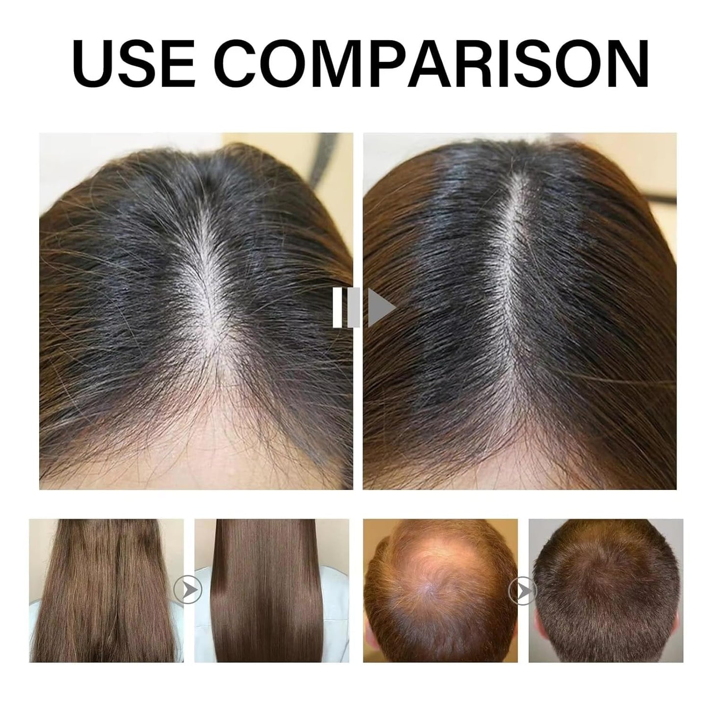 Sugar Gel Hair Growth Oil