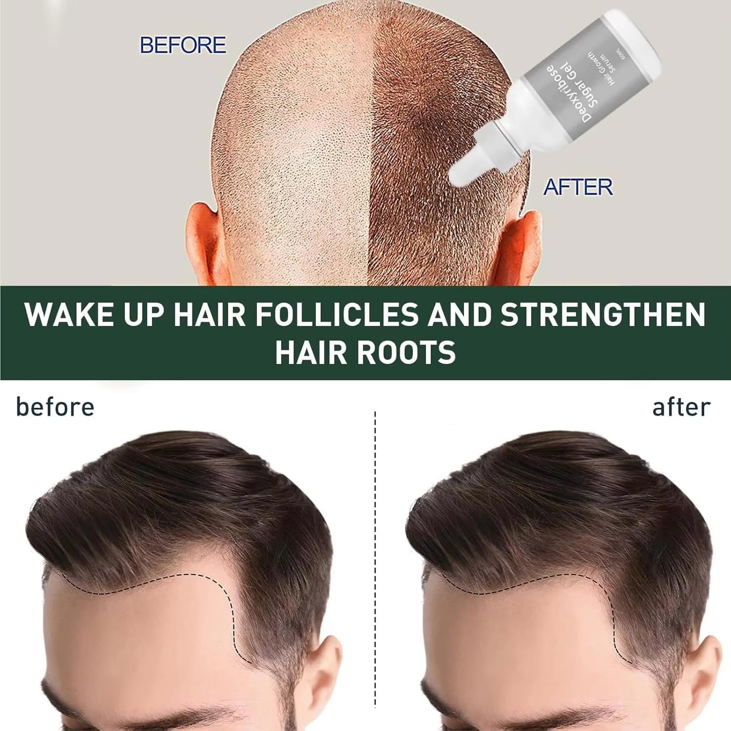 Sugar Gel Hair Growth Oil